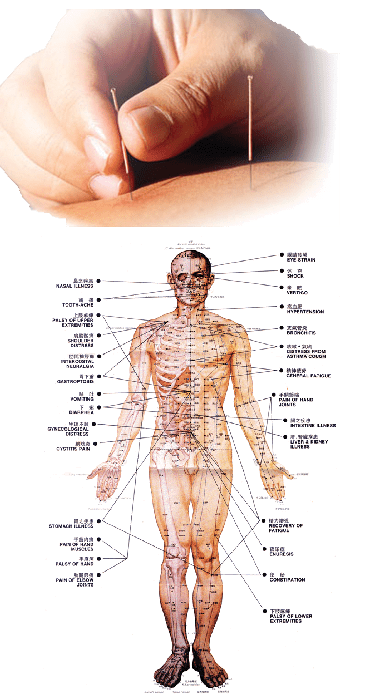 akupunktuurs1